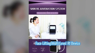 การดูแลดวงตาแบบไม่รุกราน 60W เส้นละเอียดเรียบอุปกรณ์ความถี่วิทยุหลายระดับ