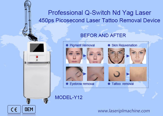 เครื่องกําจัดรอยสักเลเซอร์ 755nm Nd Yag