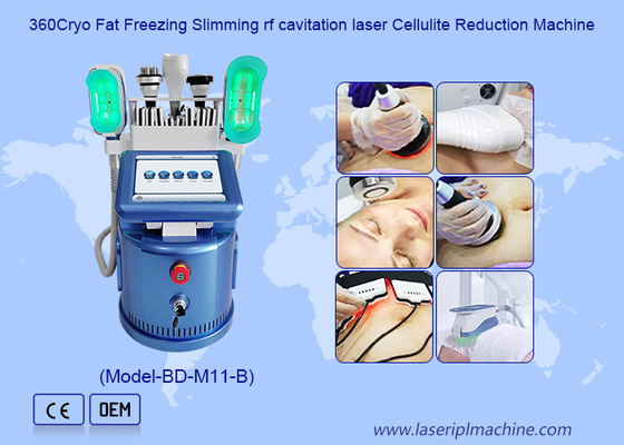 360 Cryo Vacuum RF Lipo Laser 6 ใน 1 เครื่องลดน้ําหนักลดน้ําหนัก