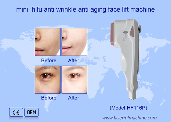 Home Use HIFU Care การกําจัดริ้วรอยบนใบหน้า การเยียวยาผิวหนัง เครื่องยกใบหน้า