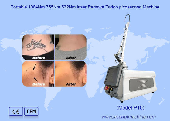 เครื่องเคลื่อนไหวผิวขาว Picosecond การกําจัดรอยสัก Nd Yag เครื่องเลเซอร์
