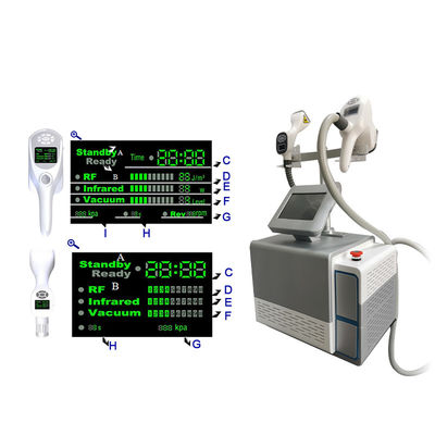 พกพา 2in1 80Kpa Cavitation 2 โซนด์ เครื่อง Vela Slimming ร่างกาย