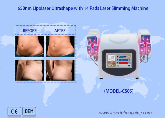 ราคาดี 650nm Lipo Laser Pads เครื่องดูดไขมันด้วยเลเซอร์เพื่อลดการกำจัดไขมันเซลลูไลท์ ออนไลน์