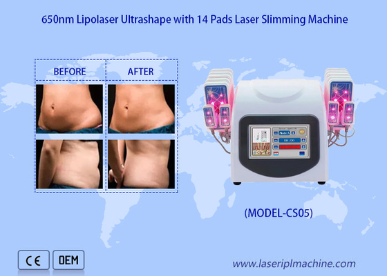 650nm Lipo Laser Pads เครื่องดูดไขมันด้วยเลเซอร์เพื่อลดการกำจัดไขมันเซลลูไลท์