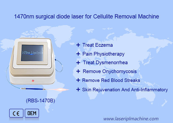 ราคาดี 1470nm 980nm ไดโอเดสเลเซอร์ ลิโปลิซิส ศัลยกรรม อุปกรณ์เลเซอร์ ออนไลน์