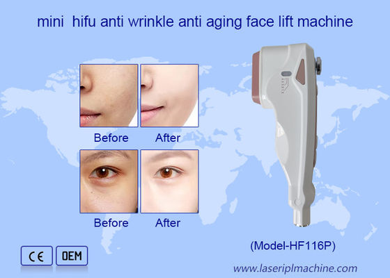 ราคาดี Home Use HIFU Care การกําจัดริ้วรอยบนใบหน้า การเยียวยาผิวหนัง เครื่องยกใบหน้า ออนไลน์
